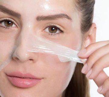 التقشير الكيميائي