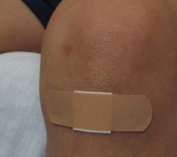 برامج الوقاية من الإصابات