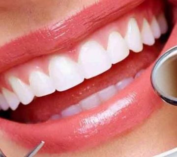 "نصائح لصحة أسنانك خلال شهر رمضان: كيفية الحفاظ على صحة الفم والأسنان خلال الصيام"