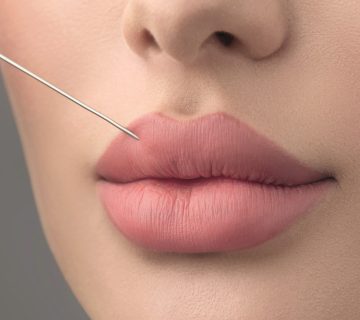 "نصائح هامة قبل إجراء البوتوكس والفيلر: كيفية التحضير والتحضير"