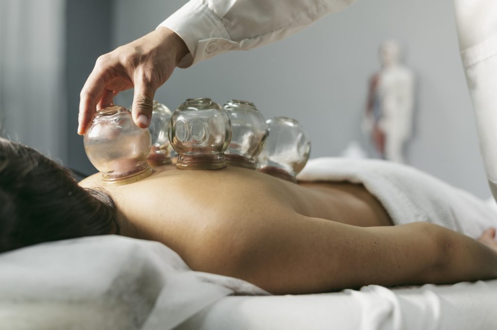 Benefits of Cupping