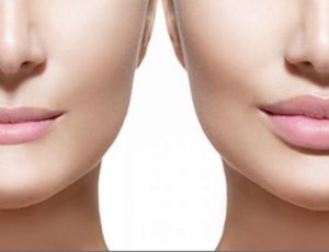 Instructions after melting filler clots