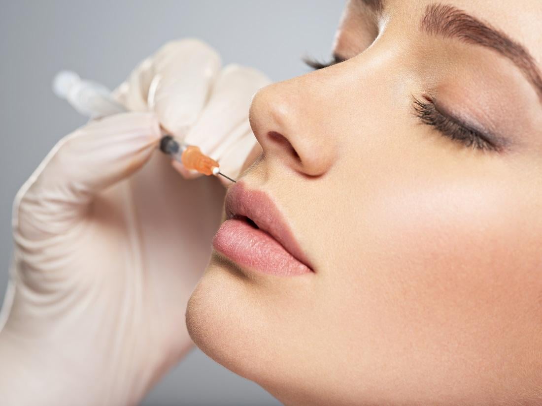 Dissolving the filler