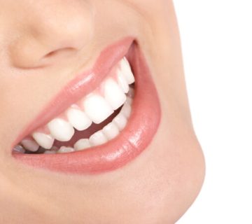 “Botox in Dentistry: A Non-Surgical Solution to the Problem of a Gummy Smile”